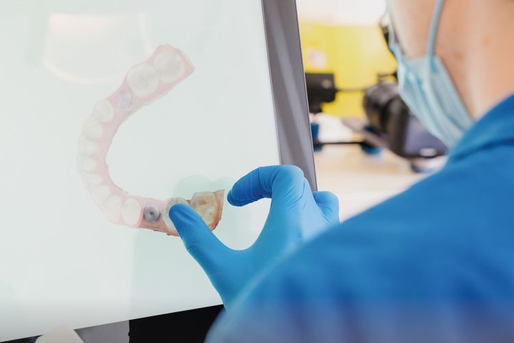 Digitale Zahnerfassung mit iTero Intraoralscanner in der Zahnarztpraxis