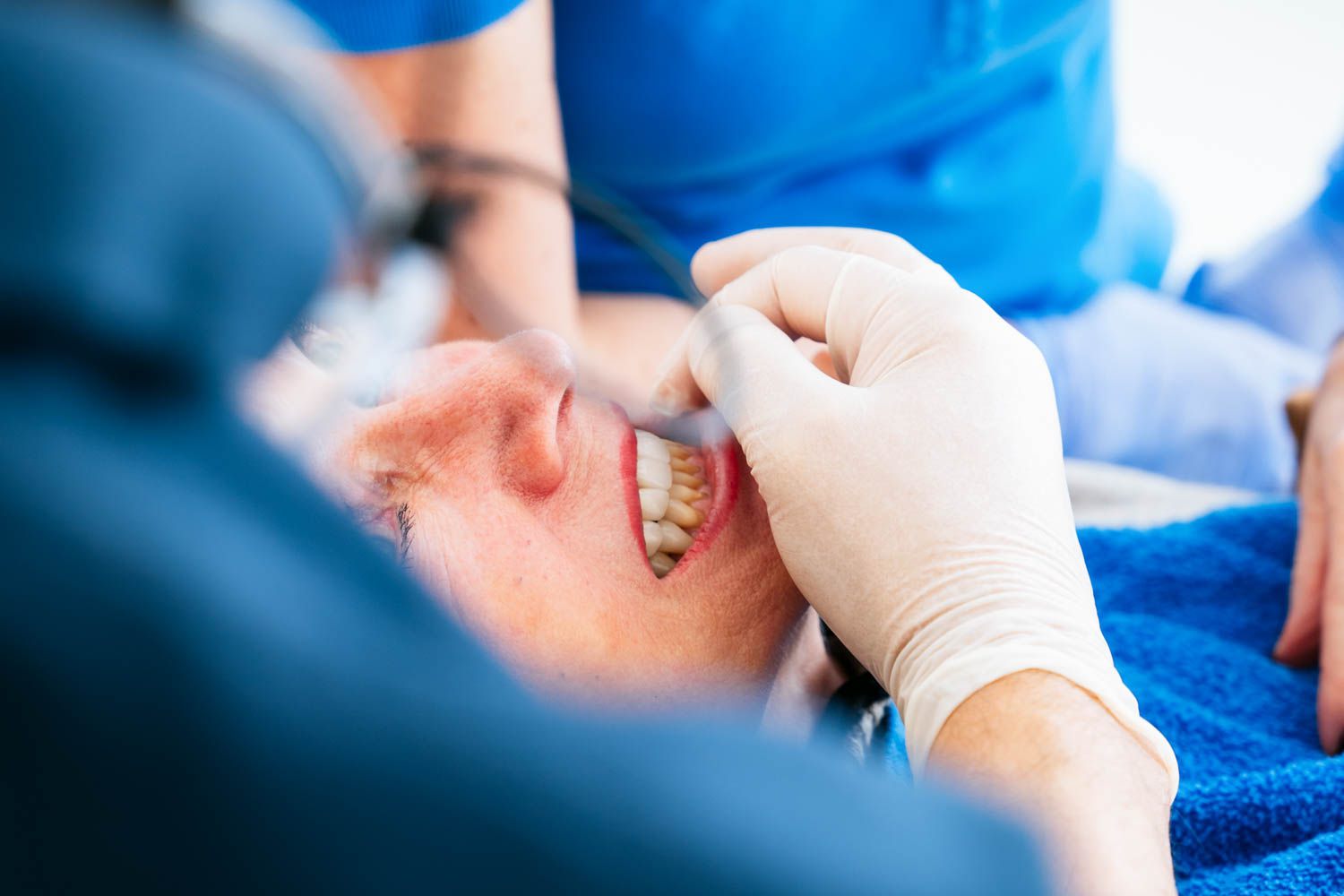 Professionelle Zahnreinigung saubere weisse Zähne